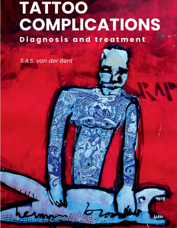 De cover van het proefschrift ovet Tattoo complications van Dr. Sebastiaan van der Bent © eigen foto