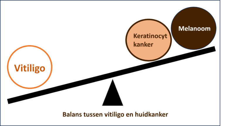 De balans tussen vitiligo en melanoom © Pigmentfonds.nl